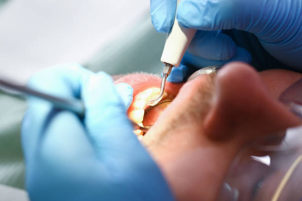 Best Mobile Emergency Dentist in Pine Hill, NJ