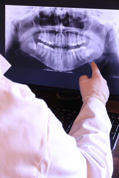 Best Broken or Cracked Tooth Emergency Dentist in Pine Hill, NJ